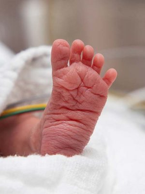 Welt-Frühgeborenen-Tag: Ein kleines Wunder braucht viele Hände. Foto: KABEG/Hipp